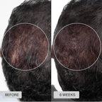 Clinically Inspired Red Light Therapy Cap for Hair Regrowth