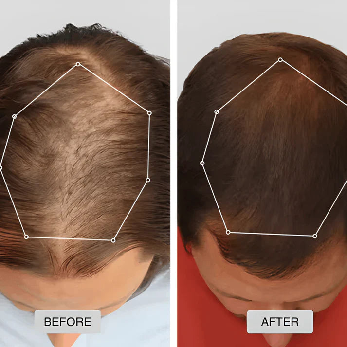 Clinically Inspired Red Light Therapy Cap for Hair Regrowth