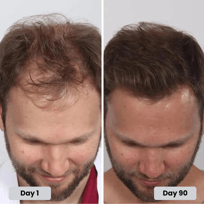 Clinically Inspired Red Light Therapy Cap for Hair Regrowth